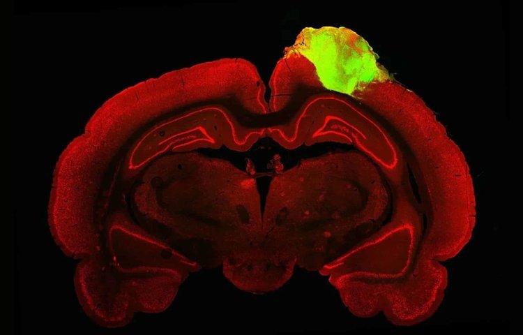 Исследователи восстановили повреждения мозга у крыс путем имплантации органоидов человеческого мозга