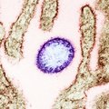 Что известно о недавно выявленном вирусе Лангья в Китае?