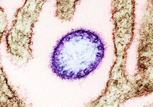 Что известно о недавно выявленном вирусе Лангья в Китае?