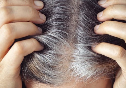 Ученые разгадали механизм, вызывающий поседение волос
