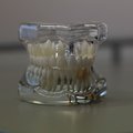 Зубное биопокрытие, похожее на натуральную эмаль, но более стойкое
