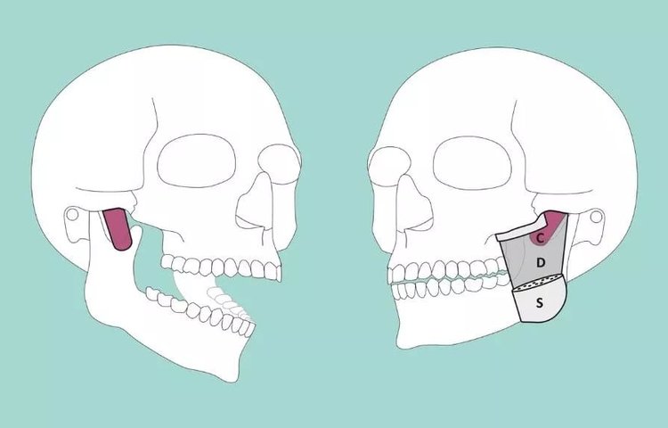 Ученые выявили третий слой мышц в человеческой челюсти