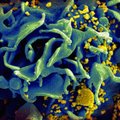 Учёные выявили второго пациента с ВИЧ, чей организм, судя по всему, избавился от вируса