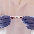 ВОЗ считает крайне маловероятным лабораторное происхождение COVID-19