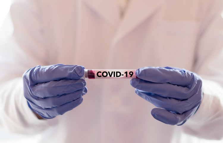ВОЗ считает крайне маловероятным лабораторное происхождение COVID-19