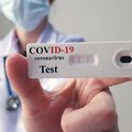Как работают тесты на антитела к коронавирусу?