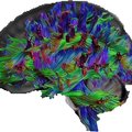 Как выглядит мозг людей с более общими знаниями?