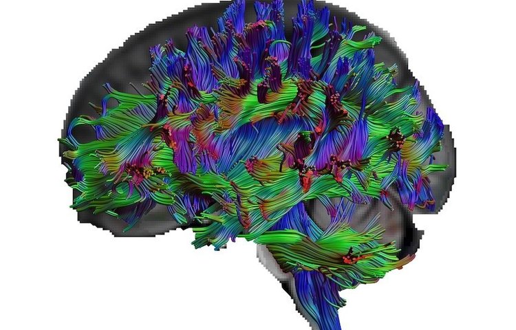 Как выглядит мозг людей с более общими знаниями?