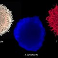 Недавно обнаруженная гибридная иммунная клетка может, наконец, объяснить причину диабета 1 типа